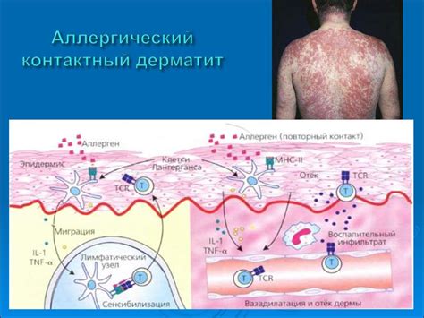 Аллергические реакции и раздражители