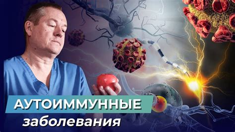 Аутоиммунные заболевания: основные принципы