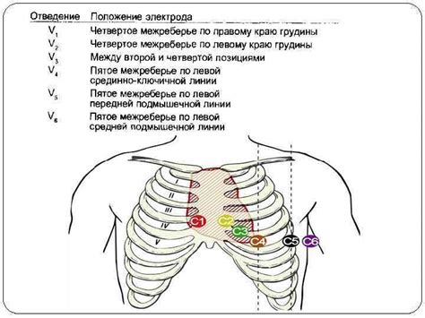 Важность своевременного проведения ЭКГ