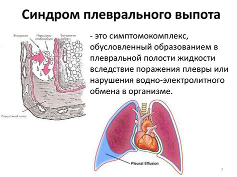 Влияние давления в плевральной полости