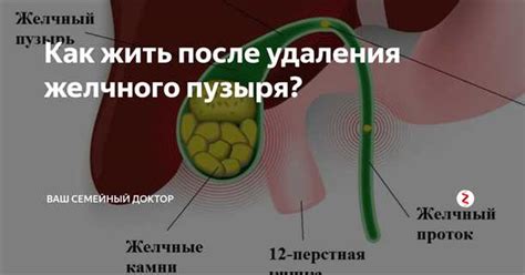 Влияние желчного пузыря на обмен веществ