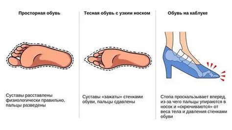 Влияние неправильной обуви