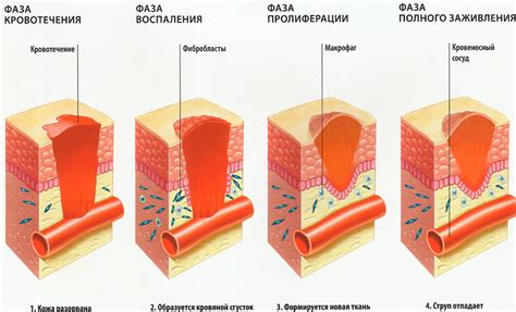 Воздействие бактерий на заживление ран