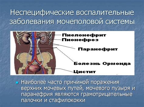 Возможное заболевание мочеполовой системы