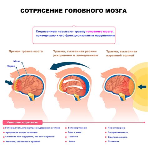 Возможность вызвать сотрясение мозга