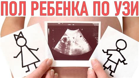 Возможные ошибки в определении пола ребенка