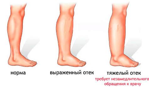 Возможные причины холодной или теплой ноги