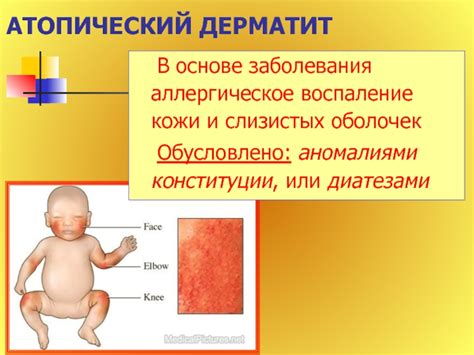 Воспаление кожи и слизистых оболочек