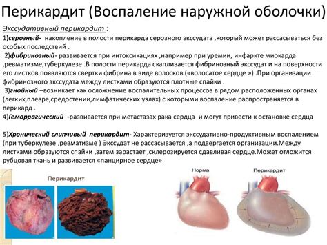 Воспалительные процессы в послеоперационной области