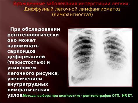 Врожденные аномалии, препятствующие полному раскрытию легких