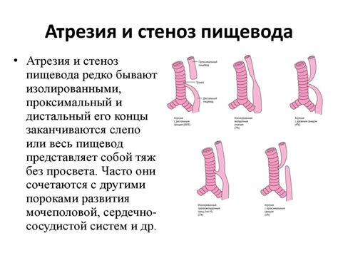 Врожденные аномалии пищеварительной системы