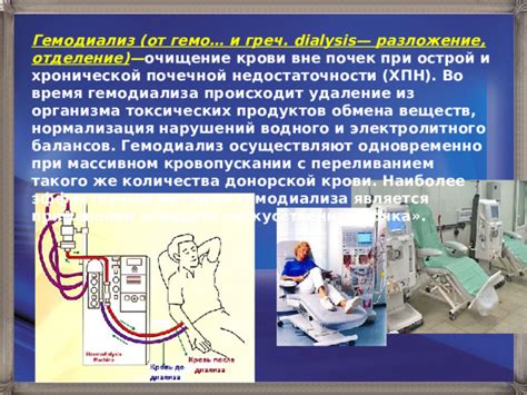 Гемодиализ и его применение