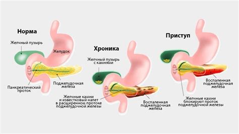 Главные причины перехода к железу