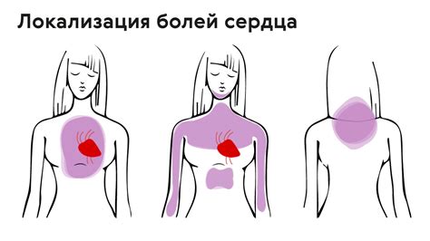 Главные причины разрыва отношений и боли в сердце