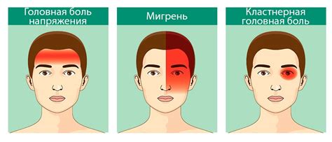 Головная боль как причина кружения головы