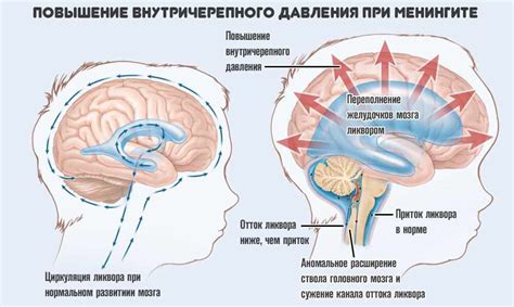 Давление на головной мозг