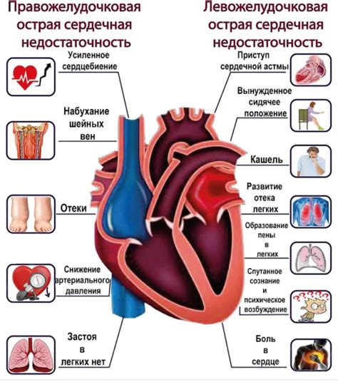 Дефектные клапаны