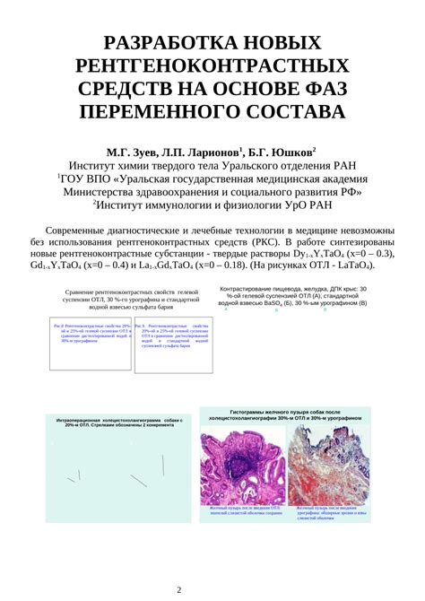 Дефицит рентгеноконтрастных средств