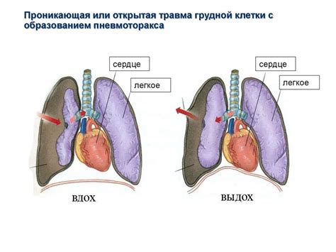 Женская характеристика в жжении в левой грудине