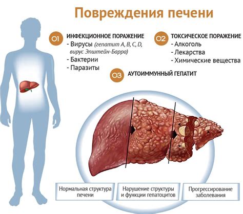 Заболевания печени и почек