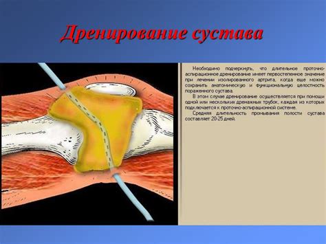 Заболевания суставов или костей