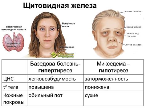 Заболевания щитовидной железы и гормональные нарушения