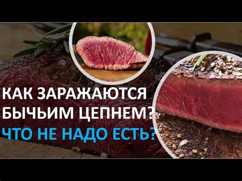 Заражение бычьим цепнем при употреблении непрожаренного мяса