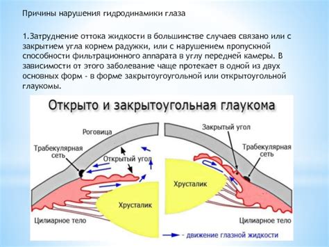 Затруднение оттока жидкости