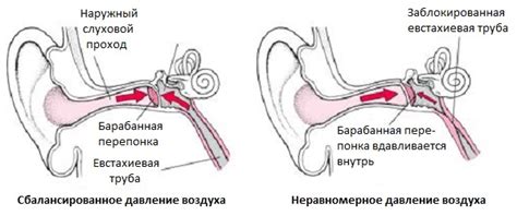 Изменение давления в ухе во время погружения и подъема