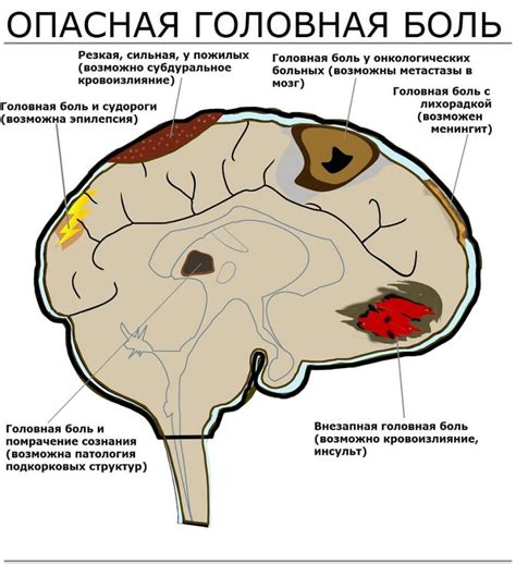 Изменение кровенапора в голове