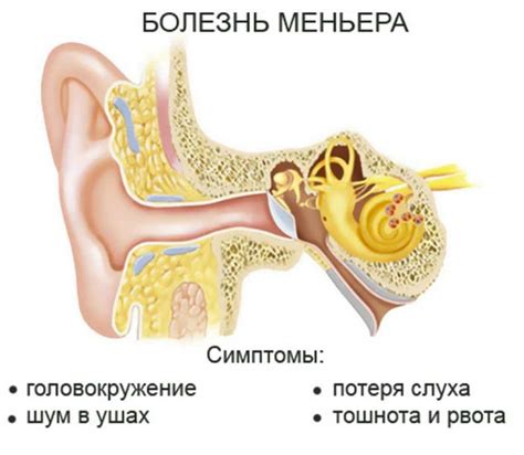 Изменения в работе вестибулярного аппарата