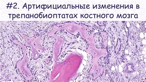 Изменения в функционировании костного мозга