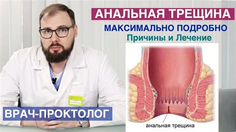 Из-за чего не заживает трещина в заднем проходе?