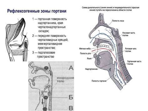 Инородные тела в носоглотке