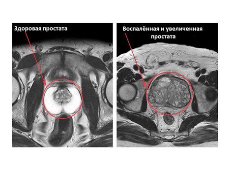 Какова продолжительность цистоскопии?