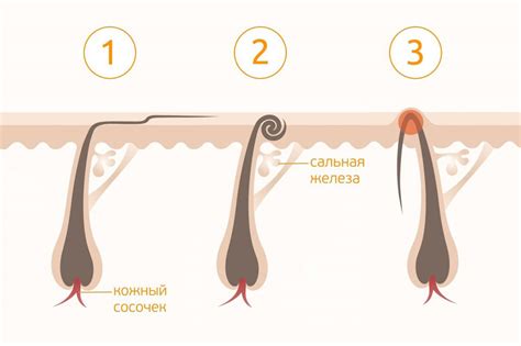 Как избежать кусания кошкой волос