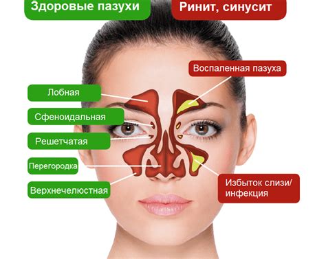 Как предотвратить покраснение носа на морозе