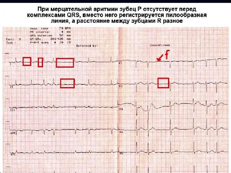 Как проводятся ЭКГ у взрослого пациента