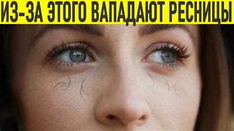 Как снизить выпадение ресниц? Рекомендации