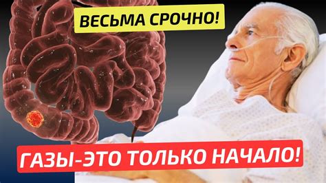 Как уменьшить газы и вздутие?