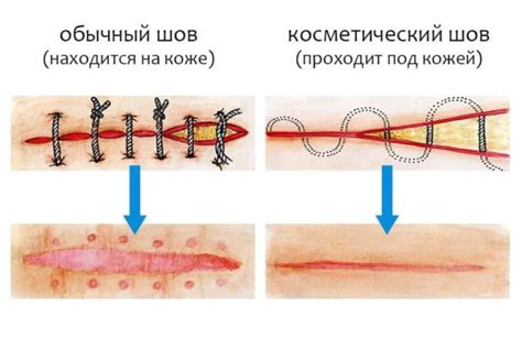 Как устранить покраснение около операционного шва