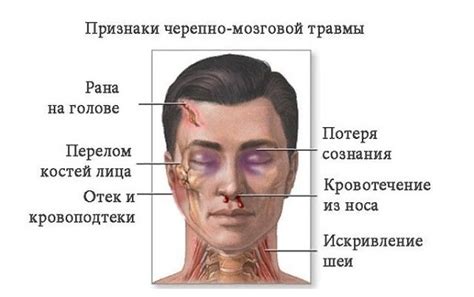 Когда необходимо обратиться к врачу после удара головой?