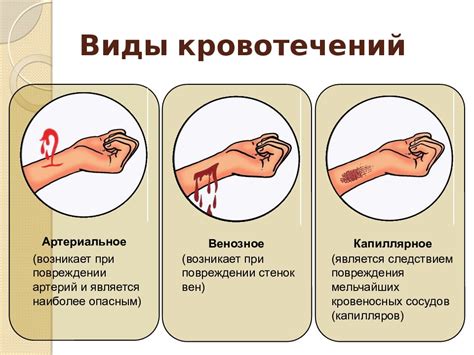 Кровотечение при высмаркивании: рекомендации