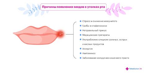 Лечение высыпаний в уголках рта