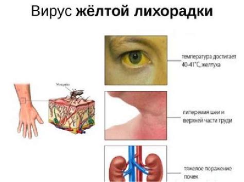 Лечение и профилактика желтой слизи