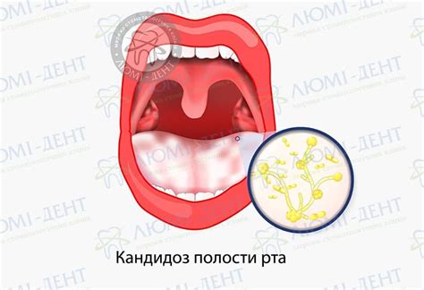 Медицинские проблемы, вызывающие сухость языка