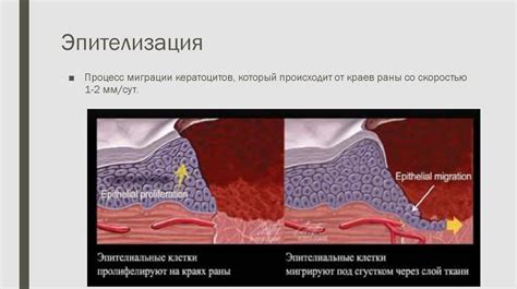 Методы лечения и их влияние на заживление