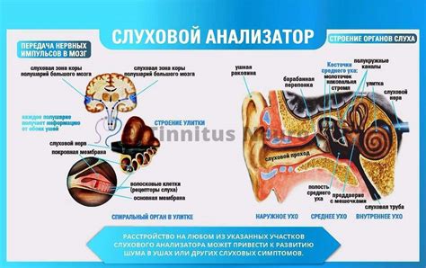 Механизмы распознавания шума