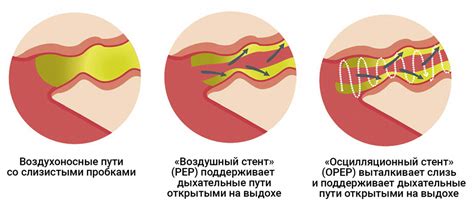 Механизм действия давления на органы