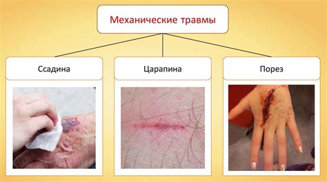 Механическое повреждение сетки или механизма